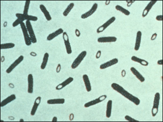 Clostridium botulinum