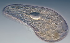 Mikrofoto.de-Blepharisma_japonicum_15